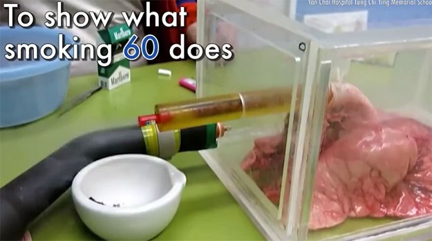 Ovaj jezivi video pokazuje kako pluća izgledaju nakon samo 60 cigareta