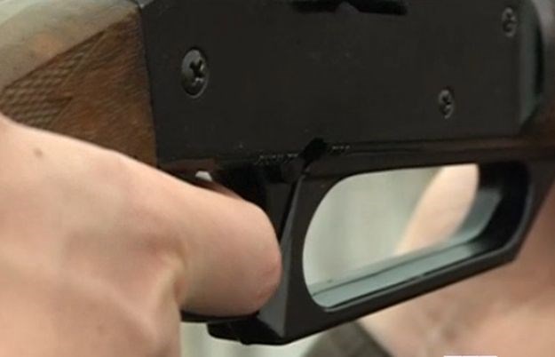 Djevojčica nastrijeljena zračnom puškom: S metkom u lubanji će možda živjeti do kraja života
