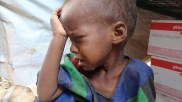 Od gladi bi u Somaliji moglo umrijeti 38 tisuća djece
