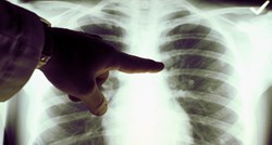 Četiri nova lijeka za rak pluća odsad preko HZZO-a