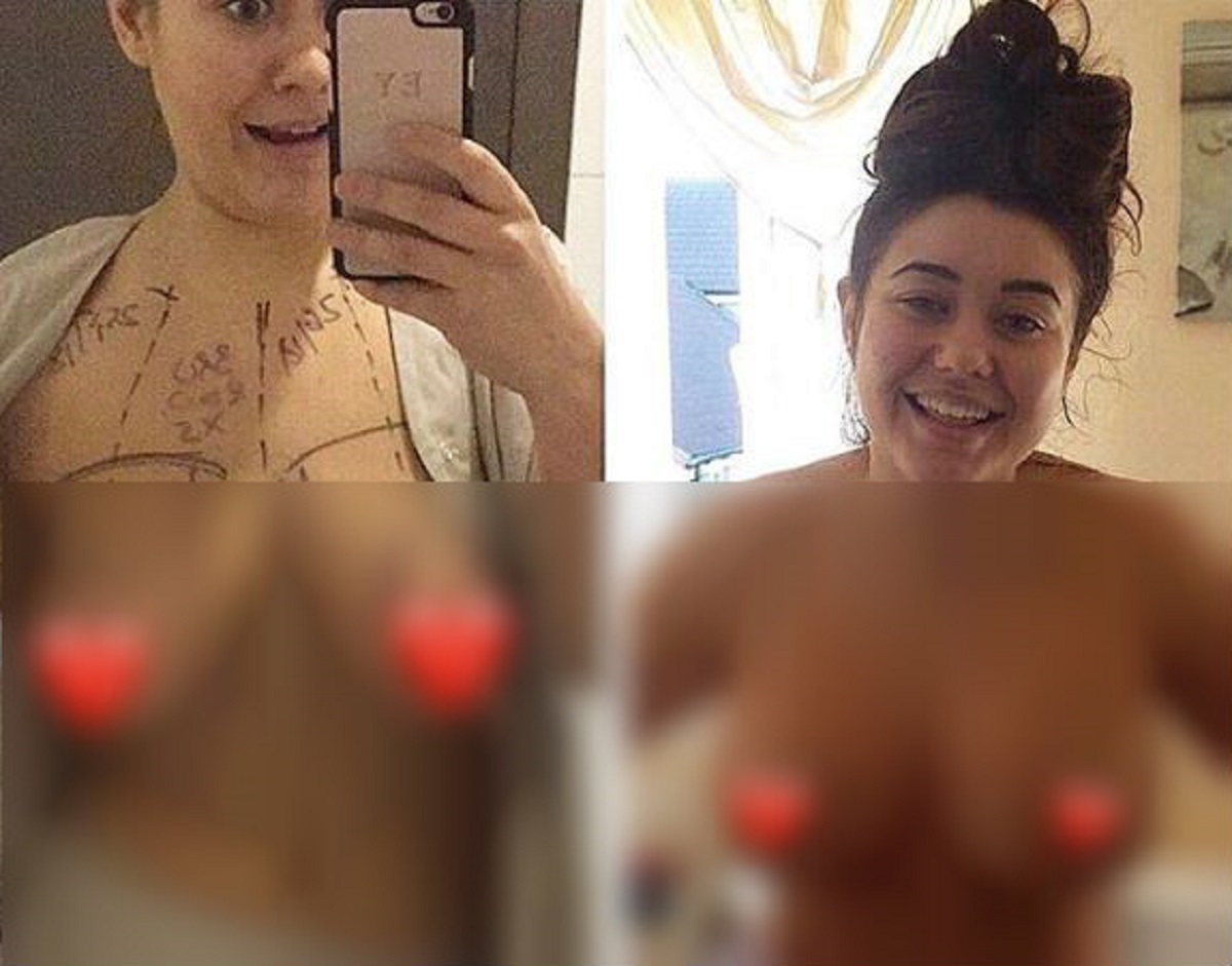 FOTO Big Brother zvijezda objavila fotku prije i poslije povećanja grudi, koje vam se sviđaju više?