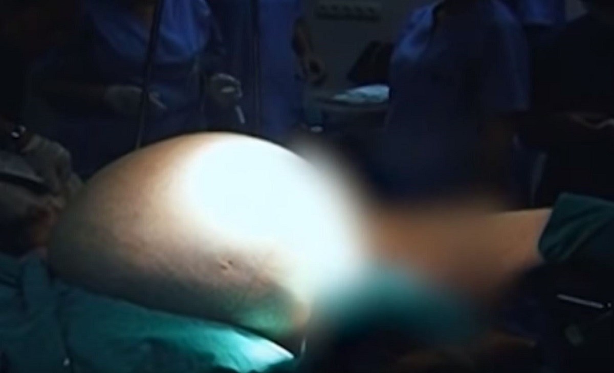 VIDEO Mislila da se udebljala, ostala u šoku kad je shvatila o čemu je riječ