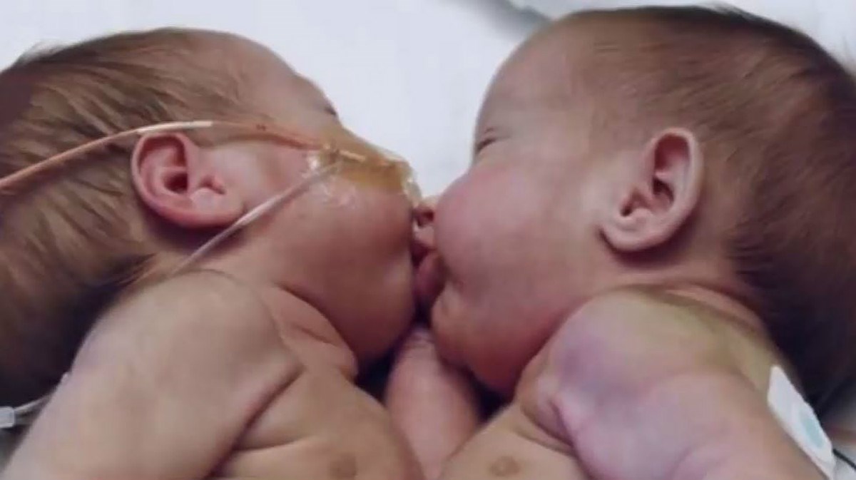 Rekli su im da će nakon razdvajanja vjerojatno umrijeti, no njihov je plan bio malo drugačiji