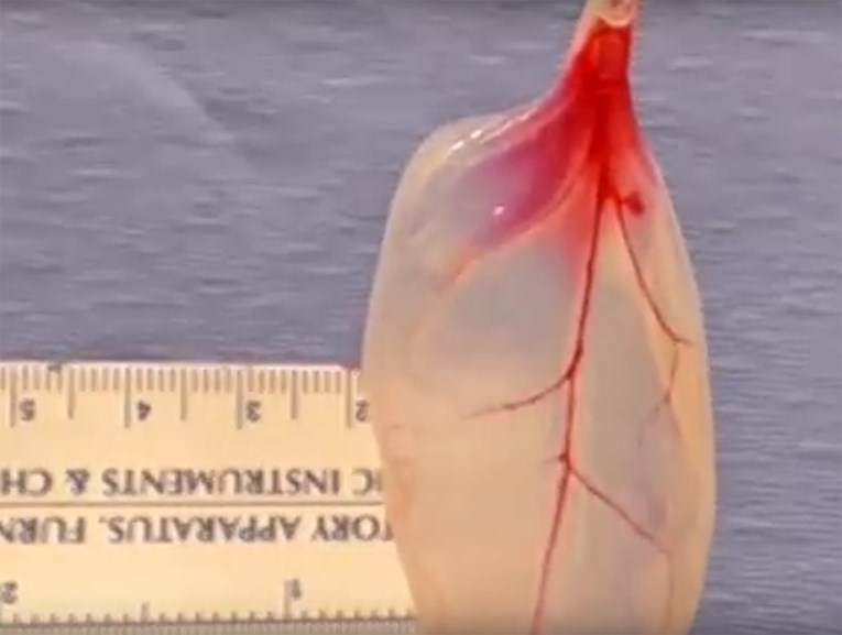 REVOLUCIONARNO Znanstvenici stvorili ljudsko srce iz lista špinata