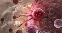 Znanstvenici u SAD-u otkrili kako zaustaviti širenje raka