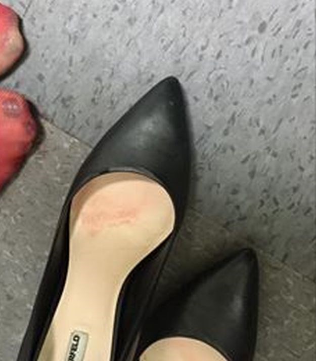 Krvav posao: Konobarica pokazala stopala nakon posla i šokirala internet