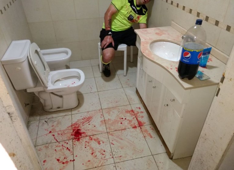 UZNEMIRUJUĆE FOTOGRAFIJE U Argentini navijači brutalno pretukli suca, krvi je bilo posvuda