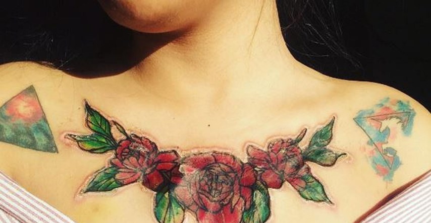 FOTO Mlada djevojka tetovažu pokušala izbrisati kemikalijom, žalit će do kraja života