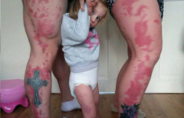 Tetovirali se kako im kćer drugi ne bi ismijavali