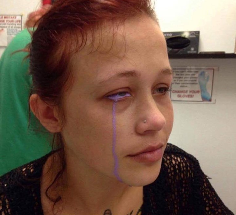 FOTO Tetovirala je oko i gadno požalila: Pogledajte što se događa kada tattoo krene po zlu