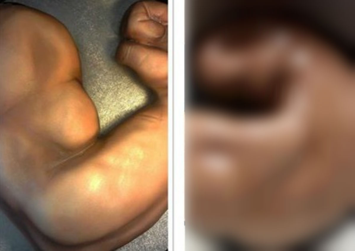 Naručila tortu u obliku bicepsa, platila je 400 kuna pa dobila totalnu slastičarsku katastrofu