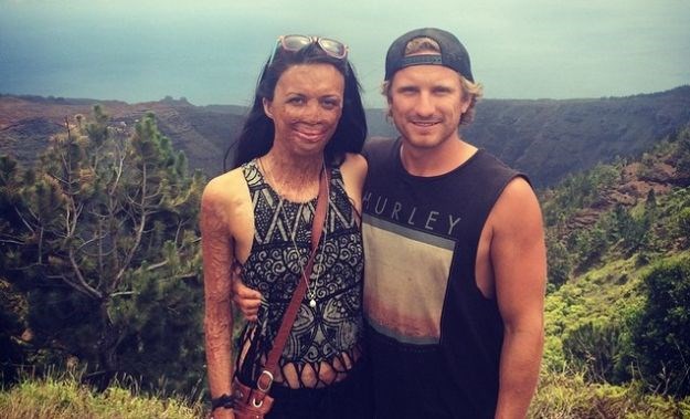 Doživjela je strašnu nesreću, a on je ostavio sve da bude uz nju: Uskoro će se vjenčati