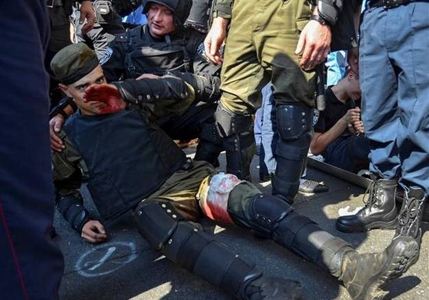 Kijev: Još jedan gardist podlijegao ozljedama, hospitalizirana 141 osoba