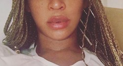 Zlobni fanovi napali Beyonce zbog "napumpanih" usnica, ali ovakav odgovor nisu očekivali