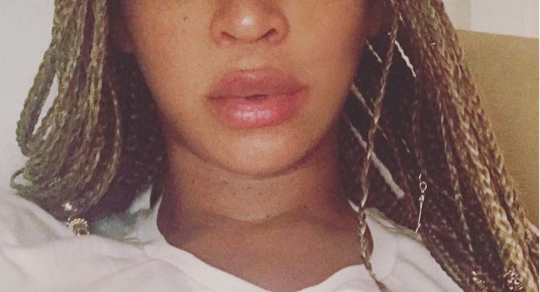 Zlobni fanovi napali Beyonce zbog "napumpanih" usnica, ali ovakav odgovor nisu očekivali