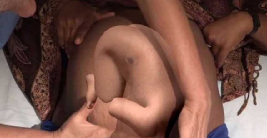 Liječnici okreću bebu okrenutu na zadak dok je još u trbuhu