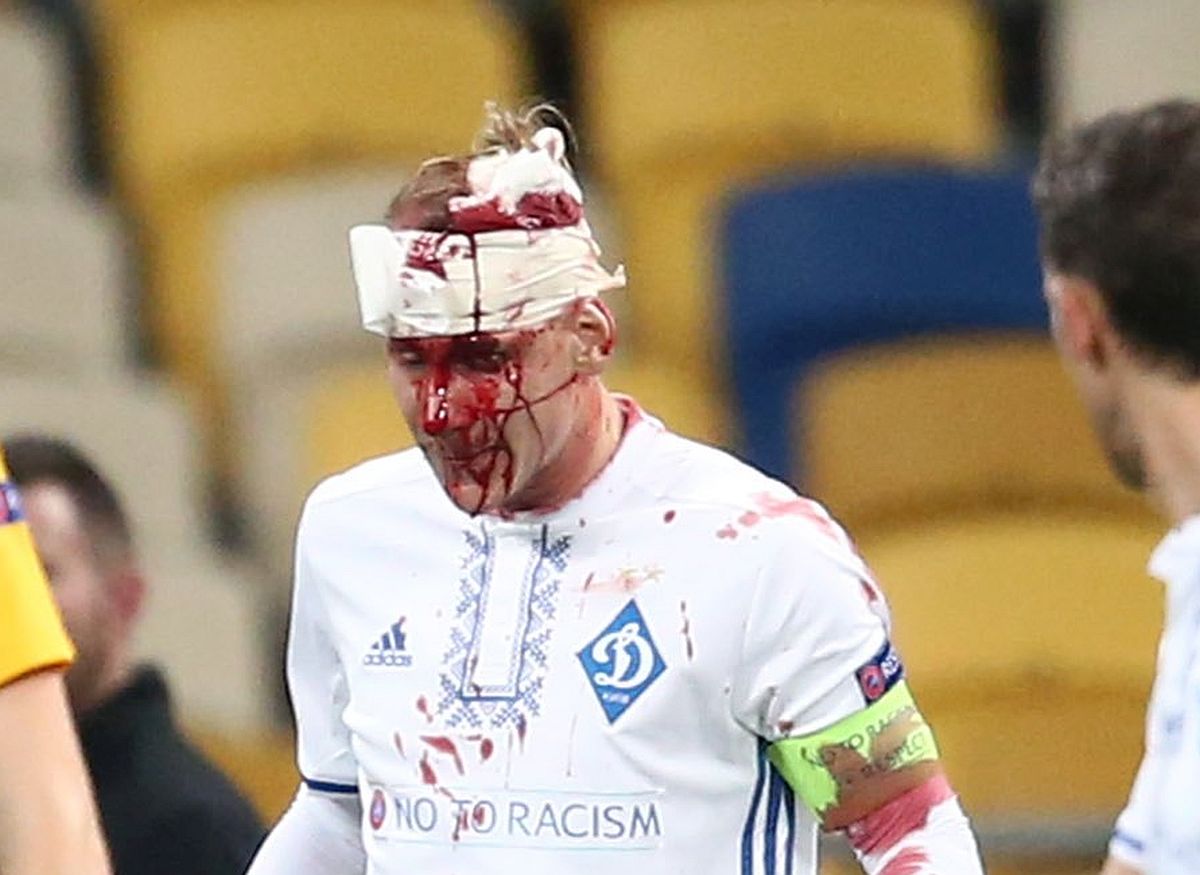UZNEMIRUJUĆA FOTOGRAFIJA Vida rasječen nakon teškog udarca u glavu, potpuno krvav odbio zamjenu