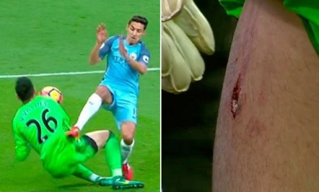 VIDEO Stravična ozljeda bivšeg vratara Barcelone koji je ipak nastavio utakmicu i postao junak