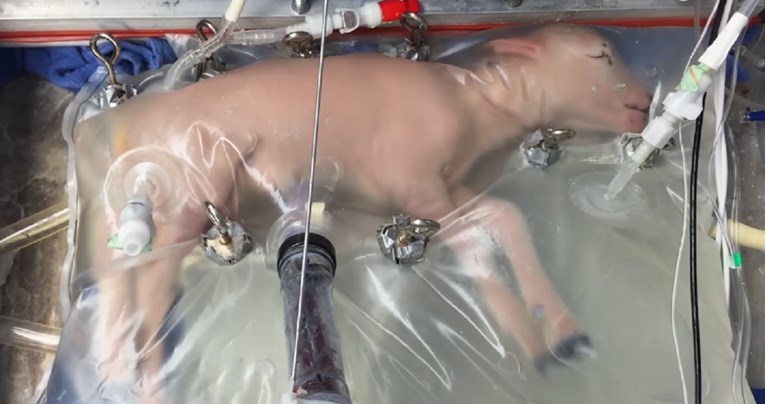 VIDEO Znanstvenici stvorili umjetnu maternicu, trebala bi smanjiti smrtnost nedonoščadi