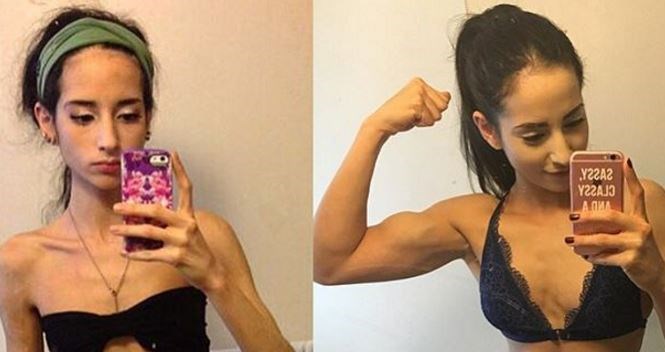 Anoreksičarka postala body building inspiracija, no priča je svejedno prilično tragična
