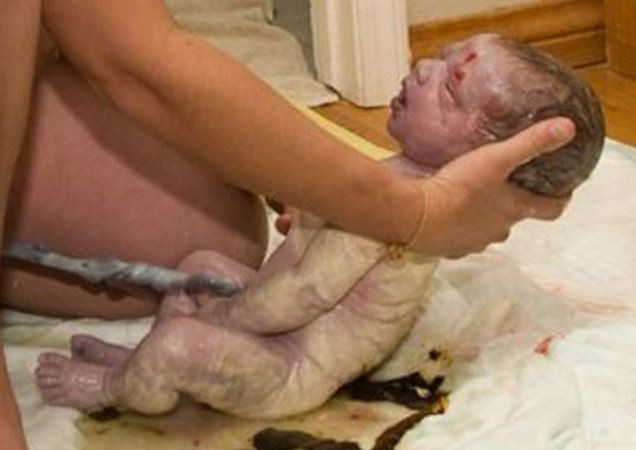 Ne bojte se crnih tragova koje neke bebe ostavljaju nakon poroda