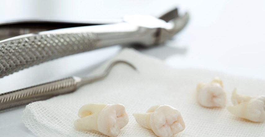 Ženi u Rusiji zubar povadio 22 zdrava zuba
