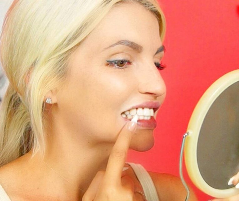 Koje metode za izbjeljivanje zuba pale, a koje su sulude?