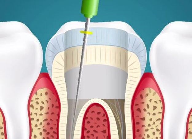 VIDEO Evo što vam zubar doista radi dok vam popravlja zub