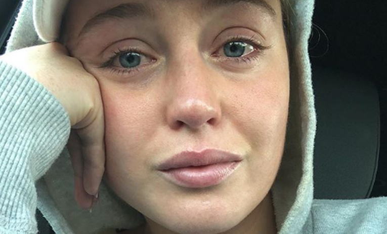 Manekenka u suzama: "Doživjela sam slom, Instagram uništava mentalno zdravlje"