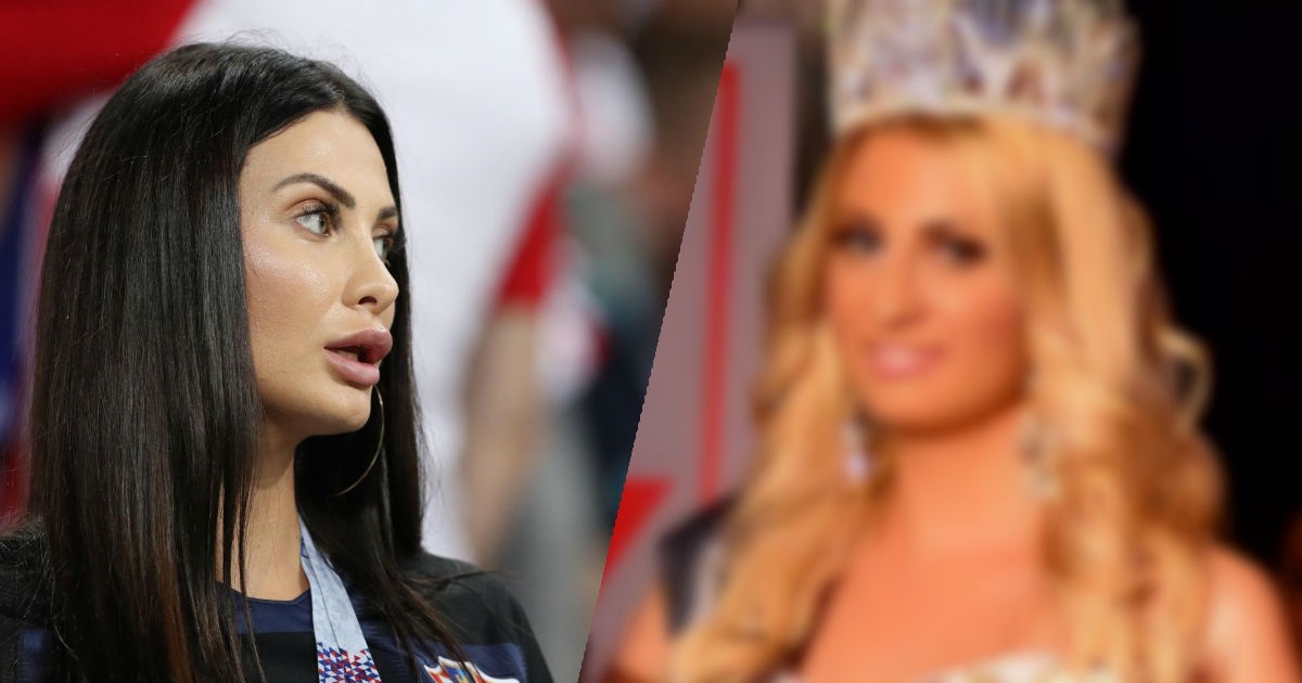 Operirala je "svašta": Pogledajte kako je Ivana Vida izgledala prije 4 godine