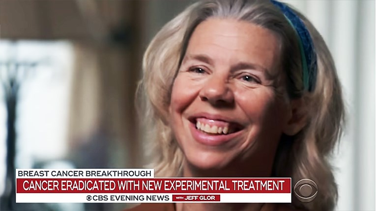 VIDEO Revolucionarno otkriće: Rak dojke u uznapredovaloj fazi prvi put izliječen imunoterapijom