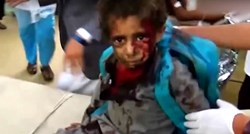 Saudijci projektilom pogodili autobus pun djece, deseci mrtvih