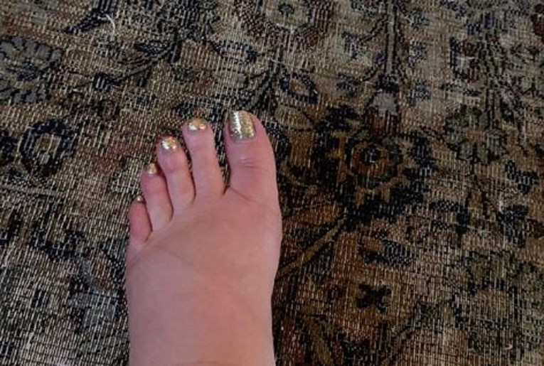 Jessica Simpson objavila fotku stopala i šokirala fanove: "Pomozite!"