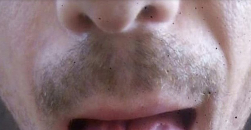 Muškarac otkrio kako izgleda jezik nakon ispijenih deset energetskih pića u danu