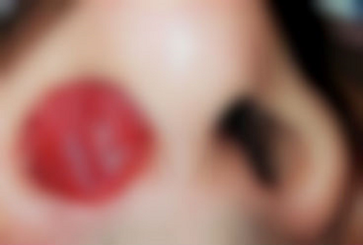 Uznemirujuća fotografija: Ovo je razvio u nosu nakon kupanja u lokalnom ribnjaku