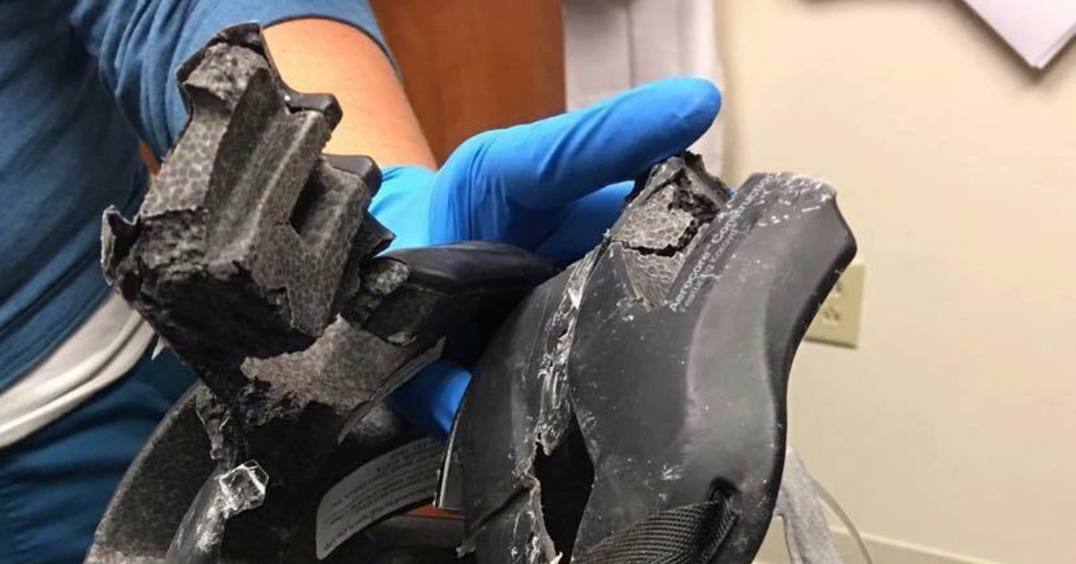 Ova viralna fotografija dokazuje koliko je važno da djeca nose kacige za bicikl