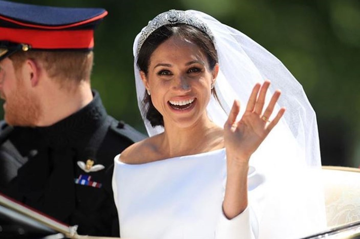 Zbog Meghan Markle žene se podvrgavaju bizarnom estetskom zahvatu