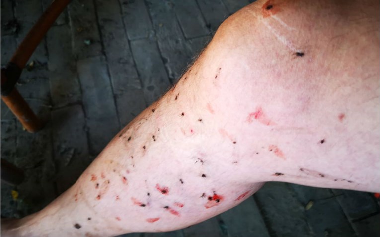 U Baranji se ne da živjeti: Evo kako izgleda čovjek kojeg su napali komarci