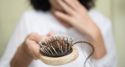 Unos ovih namirnica može pomoći spriječiti ili usporiti opadanje kose