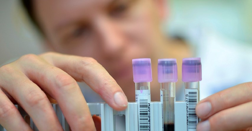 Njemačko sveučilište razvilo krvnu pretragu za rak dojke