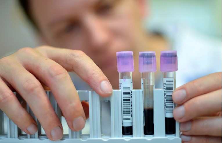 Njemačko sveučilište razvilo krvni test za rak dojke