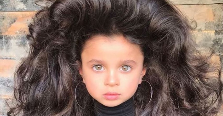 Petogodišnja djevojčica zbog nevjerojatne kose postala zvijezda