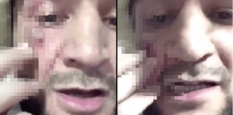 Uznemirujuće snimke: Khabibov rođak pokazao što mu je McGregor napravio od lica