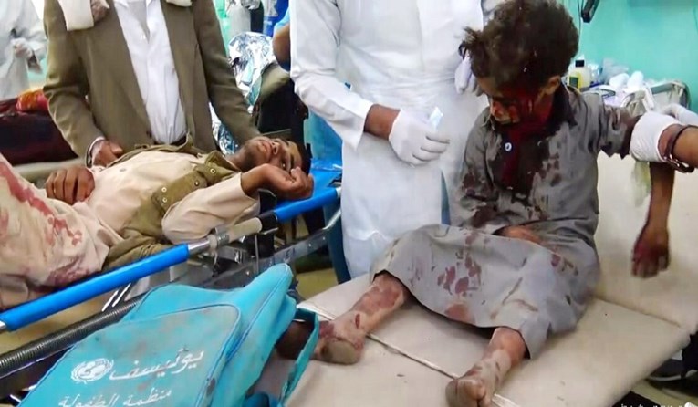 Uznemirujuće snimke: U napadu u Jemenu ubijeno najmanje 29-ero djece