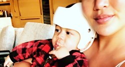 Sin Chrissy Teigen nakon tri mjeseca skinuo kacigu zbog zaležane glavice