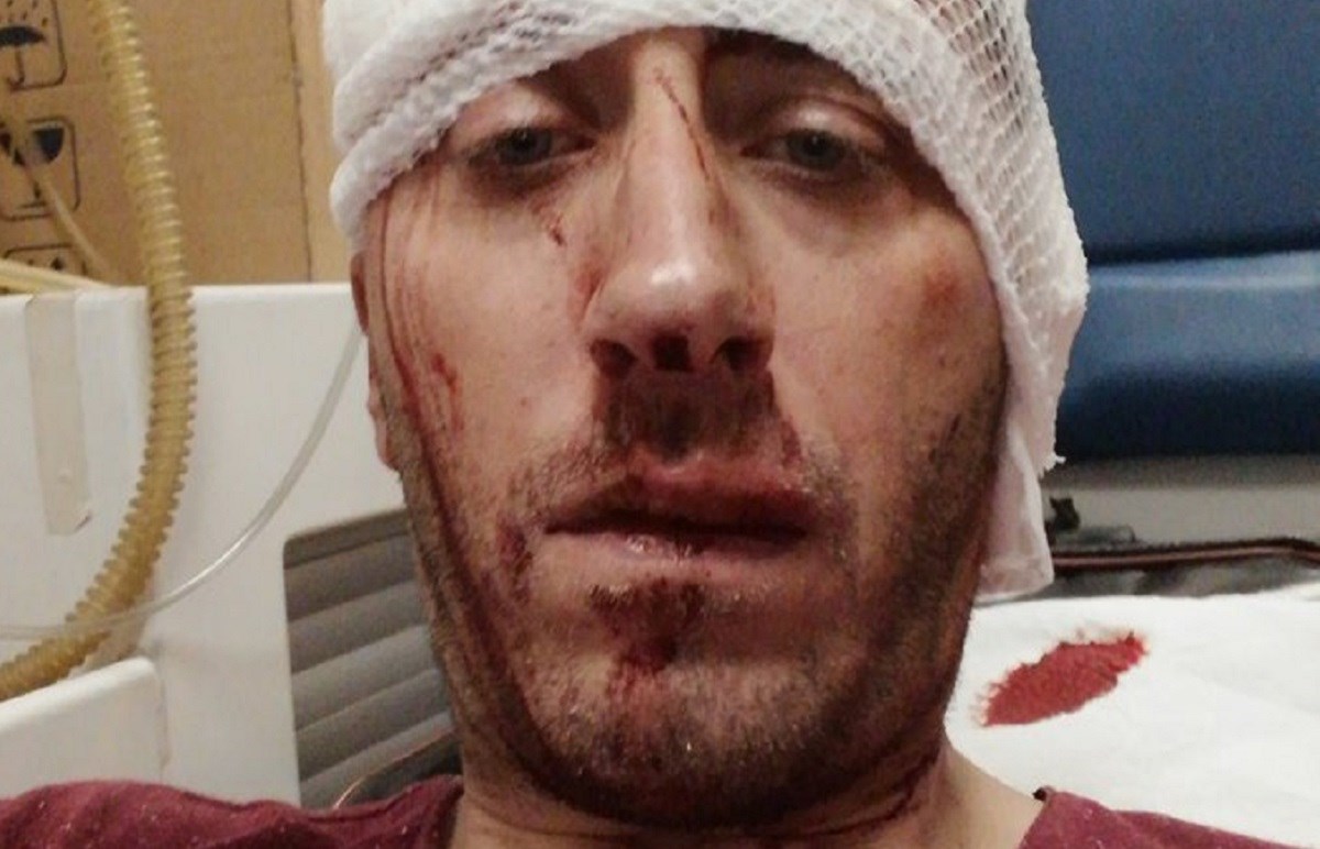 U Banjoj Luci brutalno pretučen novinar Vladimir Kovačević