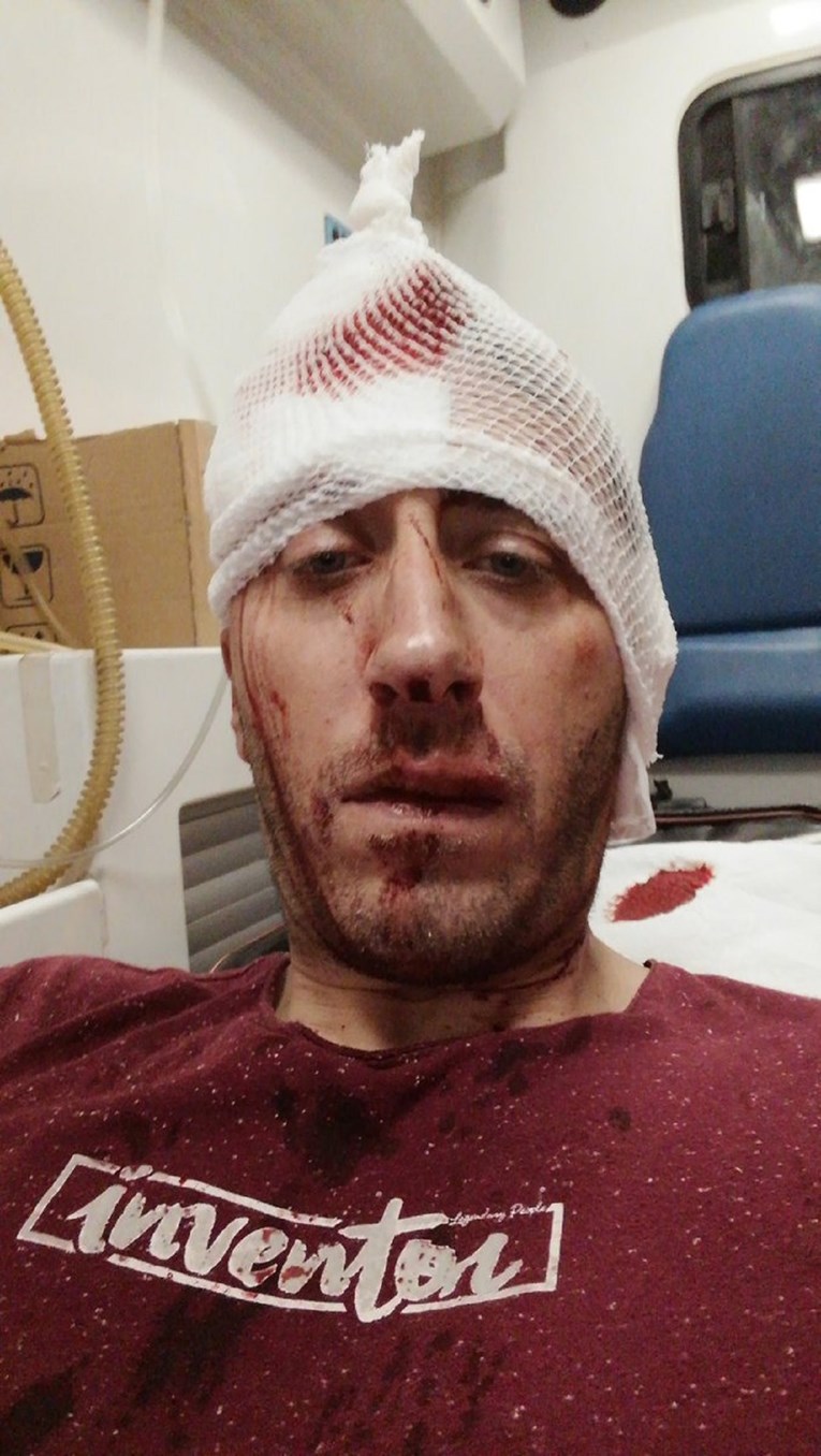Napadnuti novinar u BiH odbio se fotografirati s Dodikom