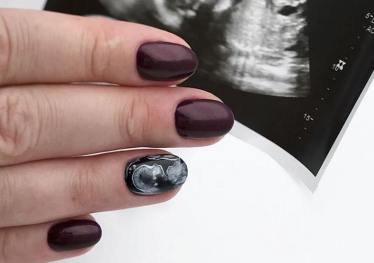 Fotografije ultrazvuka na noktima posljednji su trend među trudnicama