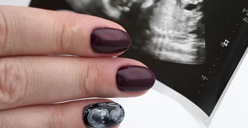 Fotografije ultrazvuka na noktima posljednji su trend među trudnicama