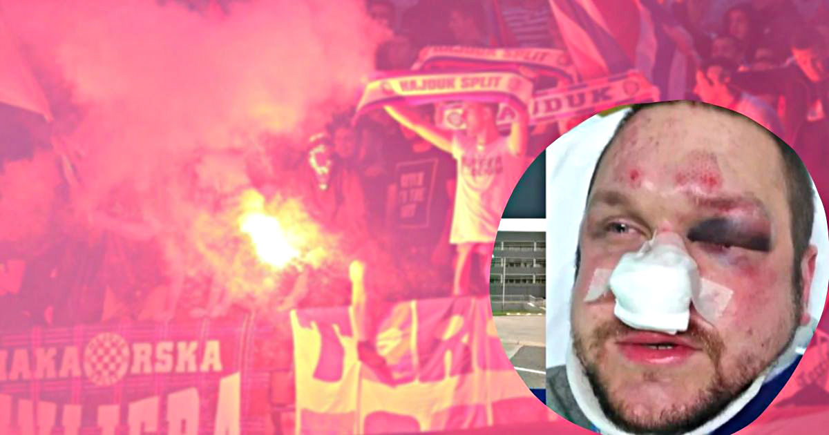 Slučajnog prolaznika u Zagrebu tukla i četvorica maloljetnih torcidaša